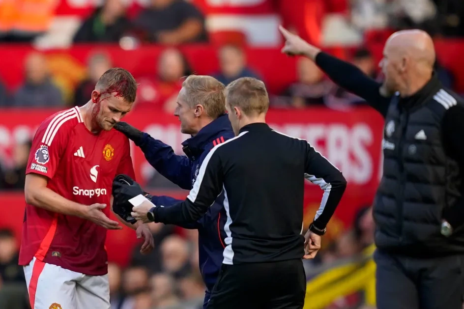 Vết thương ở đầu khiến De Light phải ra ngoài để các bác sỹ chăm sóc, khi Man Utd tiếp Brentford ở vòng 8 Ngoại hạng Anh. Ảnh: AP.