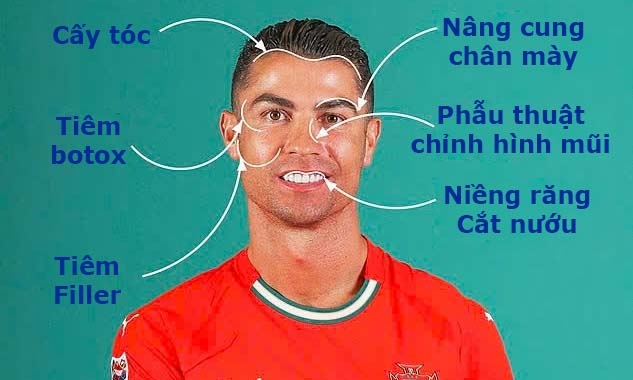 Một số can thiệp thẩm mỹ Ronaldo có thể đã sử dụng. Ảnh: Daily Mail