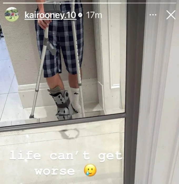 Kai chia sẻ về chấn thương. Ảnh: Instagram