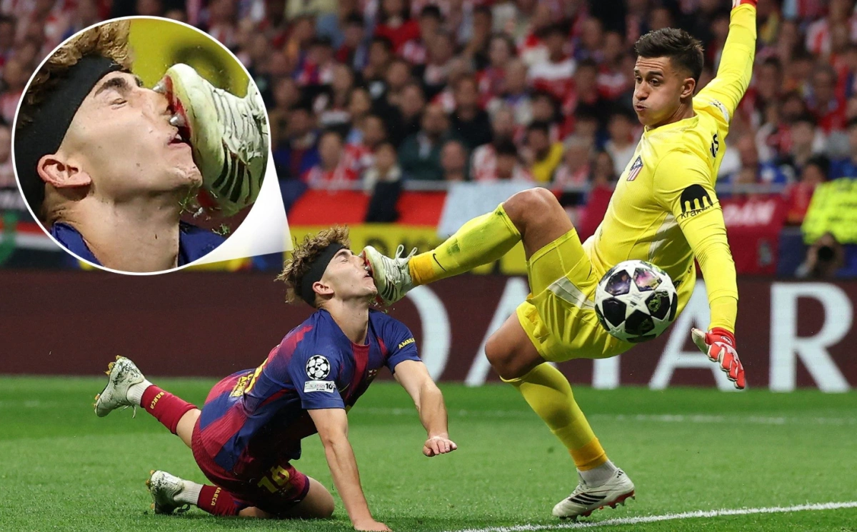 Tình huống Fermin Lopez bị thương trong trận Barca gặp Atletico Tiền vệ Barca chảy máu sau pha va chạm với thủ môn Atletico