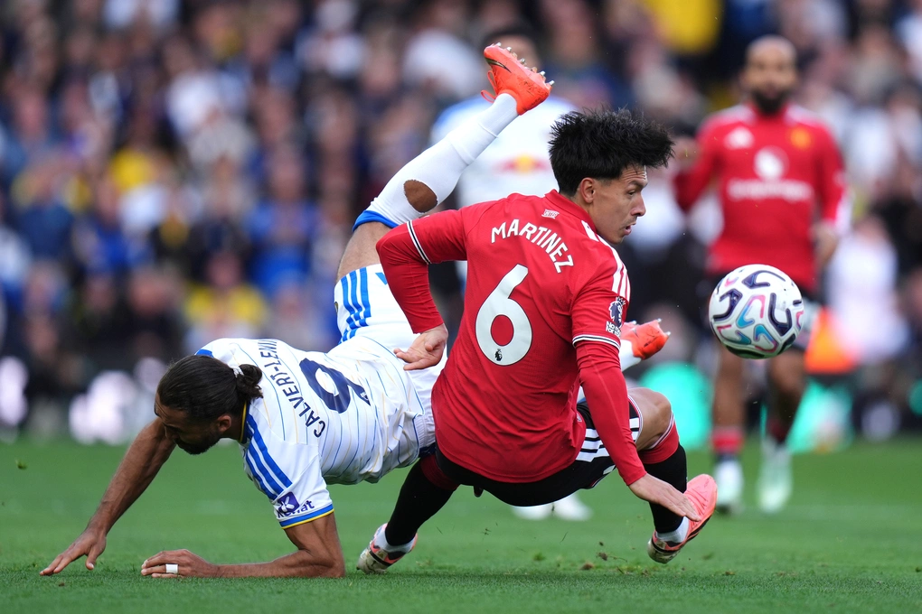 Lisandro Martinez (phải) tranh bóng với Dominic Calvert-Lewin trong trận Man Utd hòa Leeds 1-1 tại sân Elland Road, Leeds, Anh ngày 18/10/2026. Ảnh: AP